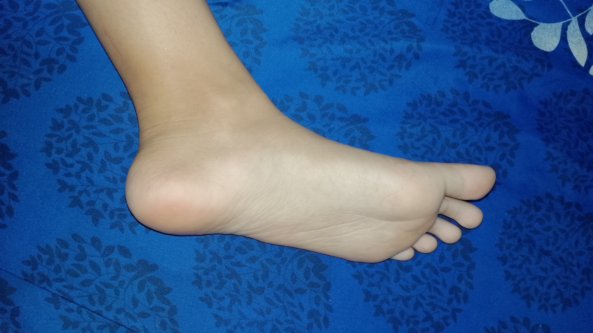 Cara mengatasi telapak kaki pecah-pecah menggunakan bahan alami
