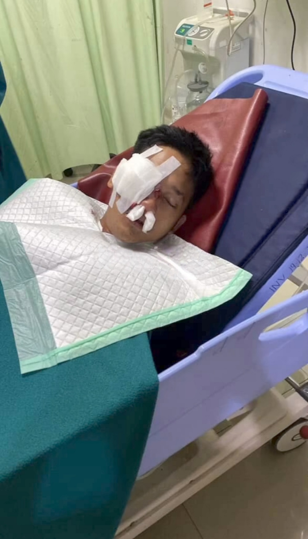 Korban AJ, warga Salaman, Kabupaten Magelang menjadi korban penyerangan tiga pelajar.