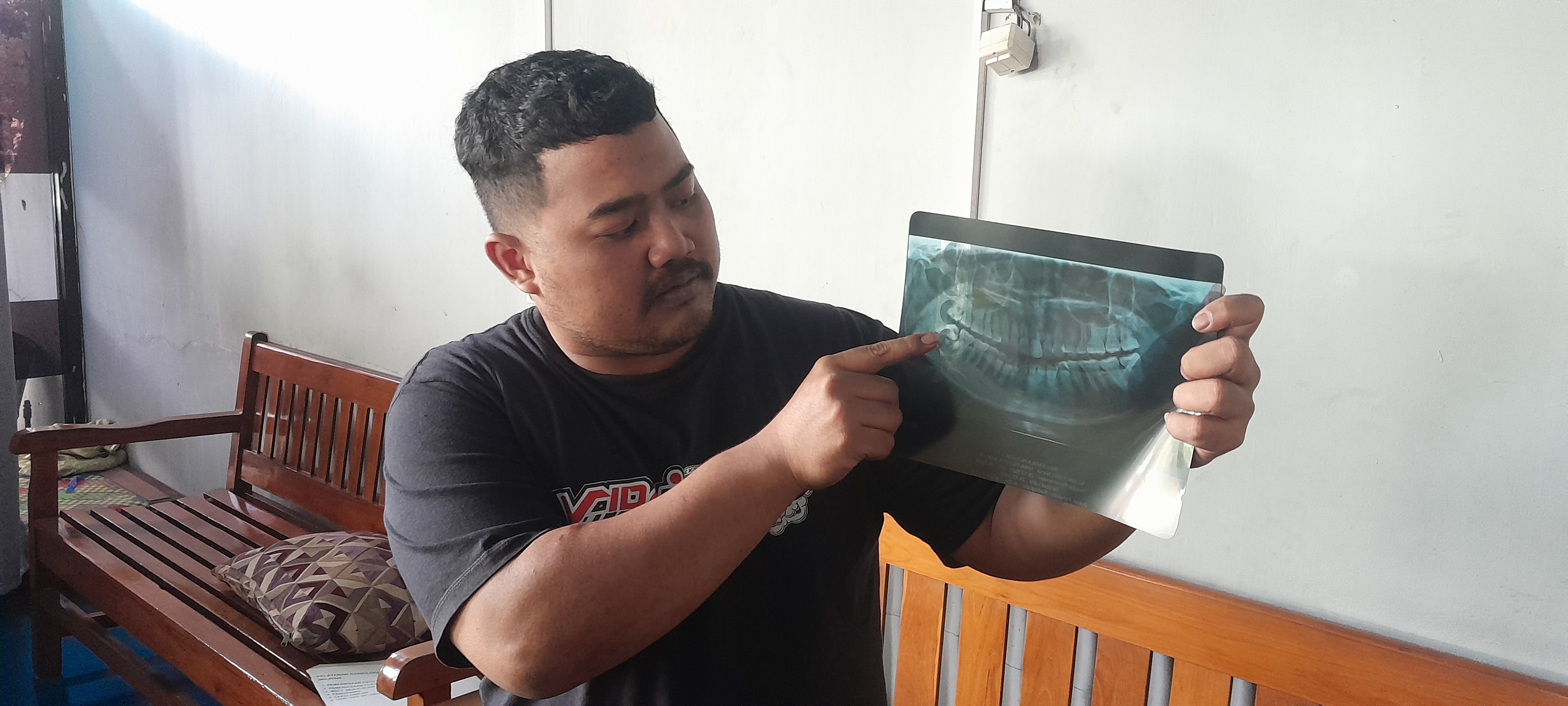 PERIHAL MEDIS: Davin menunjukkan hasil rontgen gigi istrinya yang meninggal dunia pada 27 April 2024. (ASEP SYAEFUL BACHRI/JAWA POS RADAR NGAWI)