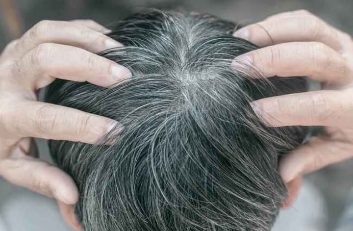 Tandai gejala rambut kamu mulai beruban.