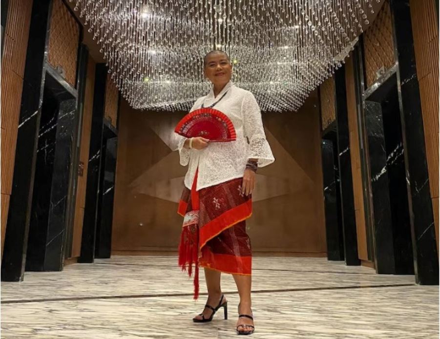 Terry Endropoetro tetap tampil cantik dan percaya diri dengan kepala tanpa rambut.