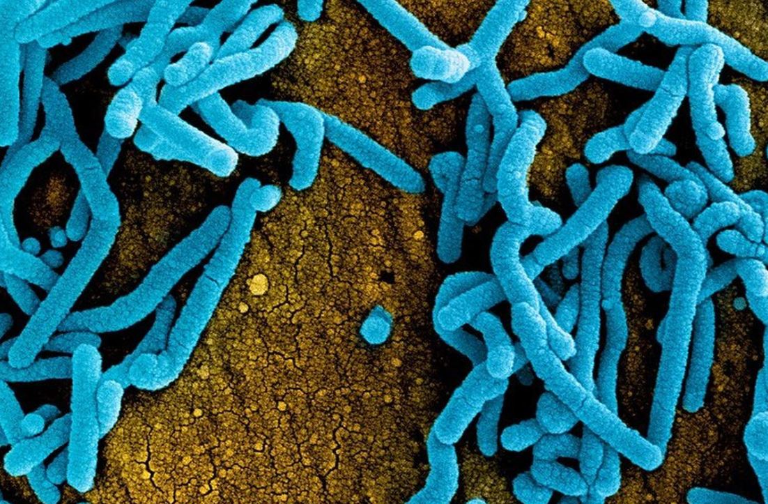 Ethiopia konfirmasi wabah pertama virus Marburg, WHO langsung kirim dukungan medis dan tim tanggap darurat.