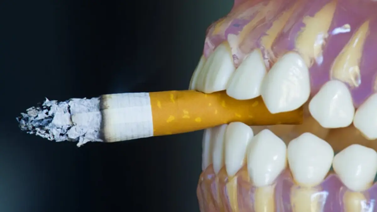 Merokok Bisa Berpengaruh Pada Kesehatan Gigi. Foto: hambrugdentalcare.com

