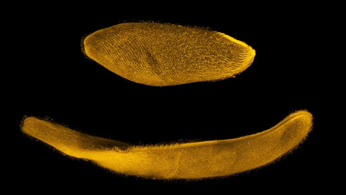 Ambiguum Spirostomum (Joseph Lannan)