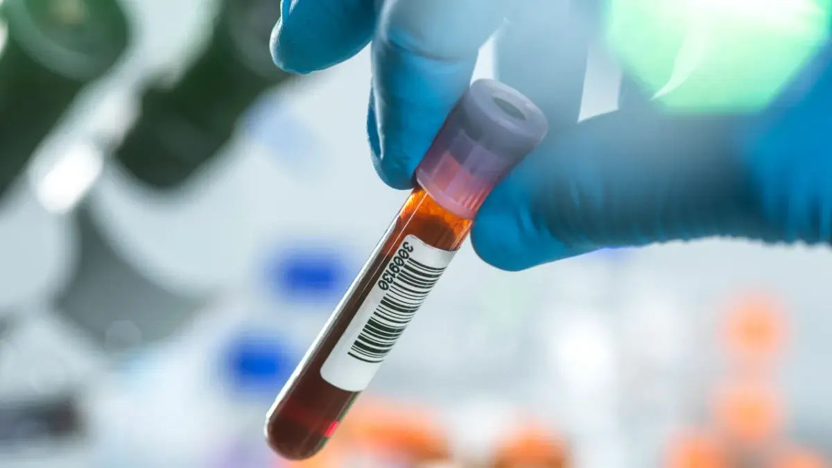 Ilmuwan menemukan tanda protein dalam darah yang berkaitan dengan penuaan sehat (TEK IMAGE/SCIENCE PHOTO LIBRARY via Getty Images)