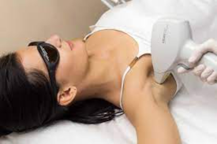 Ikustrasi IPL hari removal (Foto : Pinterest)