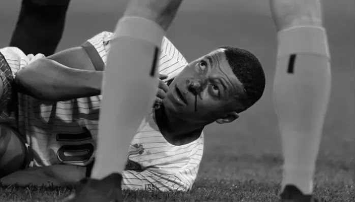 Kylian Mbappe patah hidung, saat pertandingan Grup D Euro 2024 lawan Austria (Getty Images/Soccrates Images)