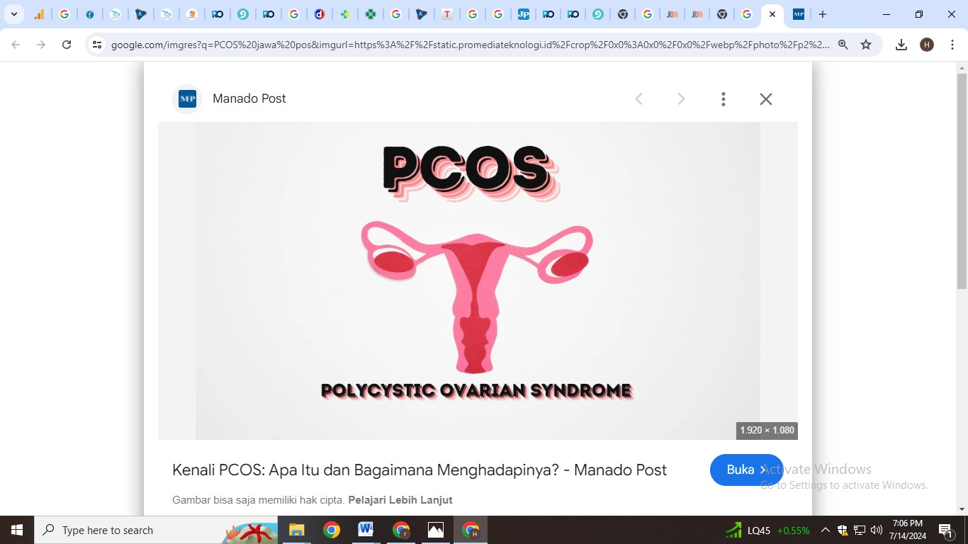 ilustrasi PCOS (pexels.com)