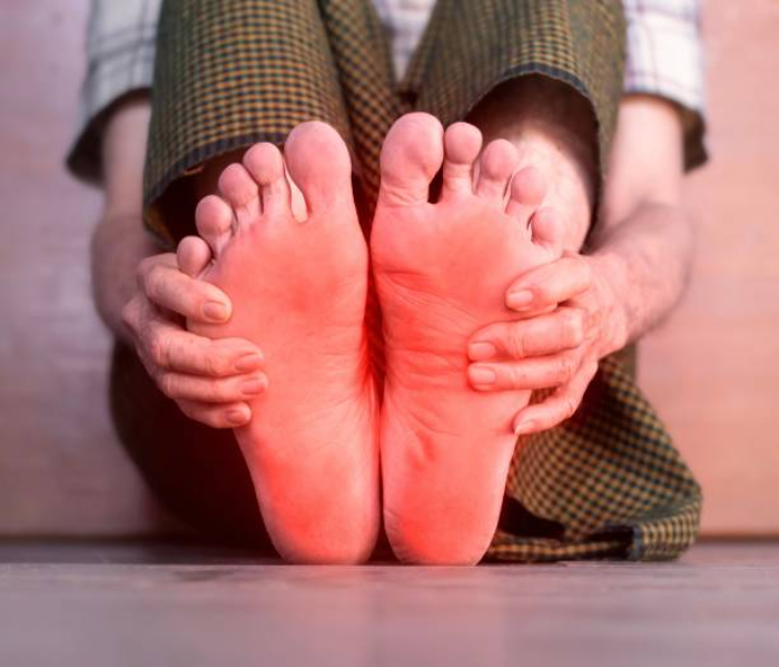 Foto: iStock