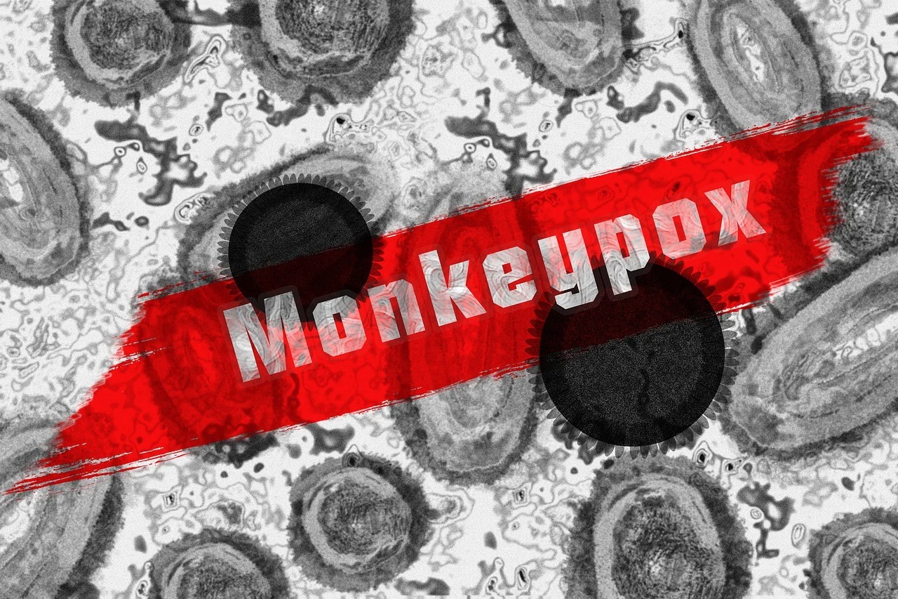 Wabah Mpox serang dunia. Foto: geralt/Pixabay