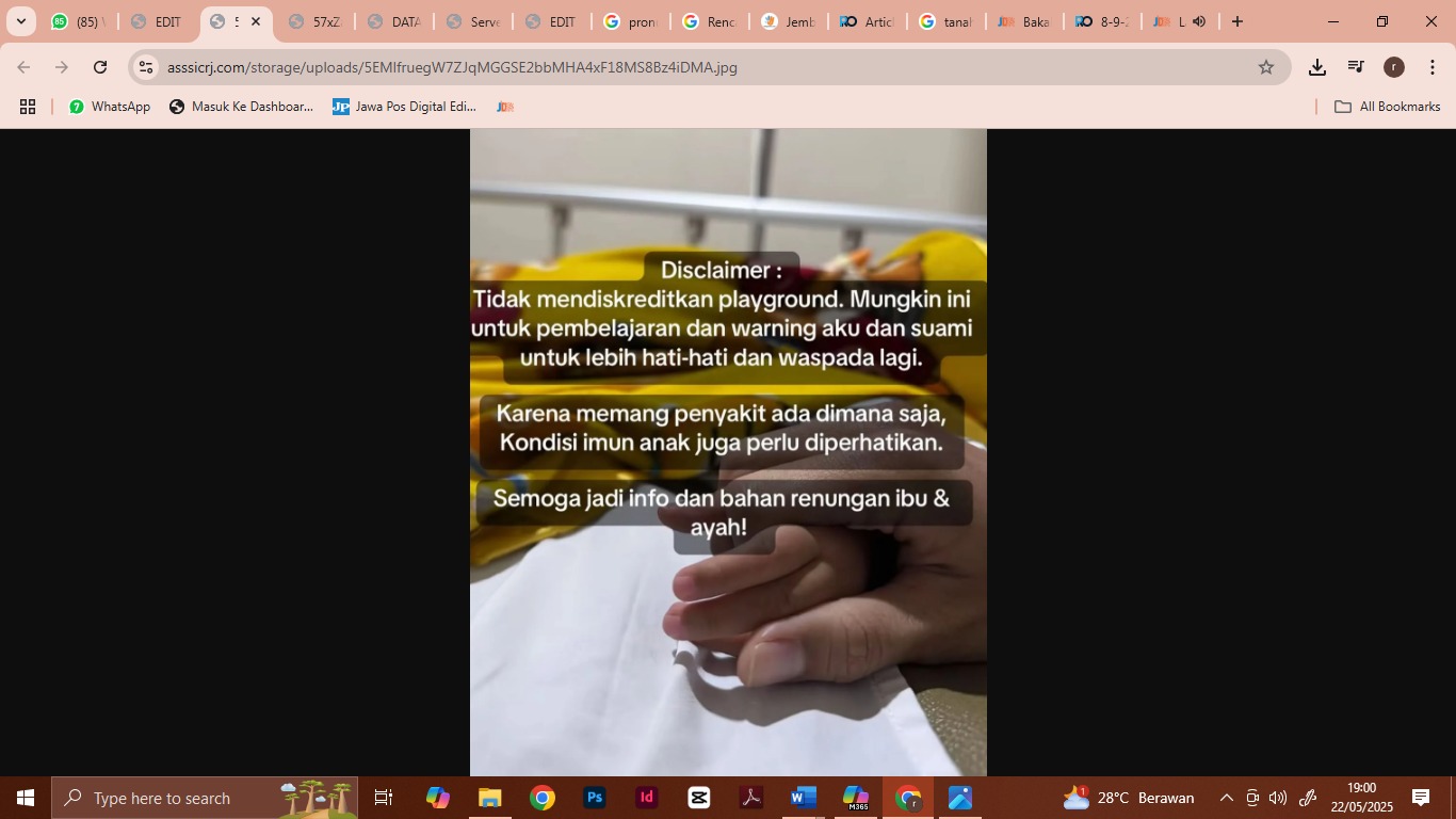 Seorang ibu membagikan kisah anaknya yang sakit setelah bermain di Playground