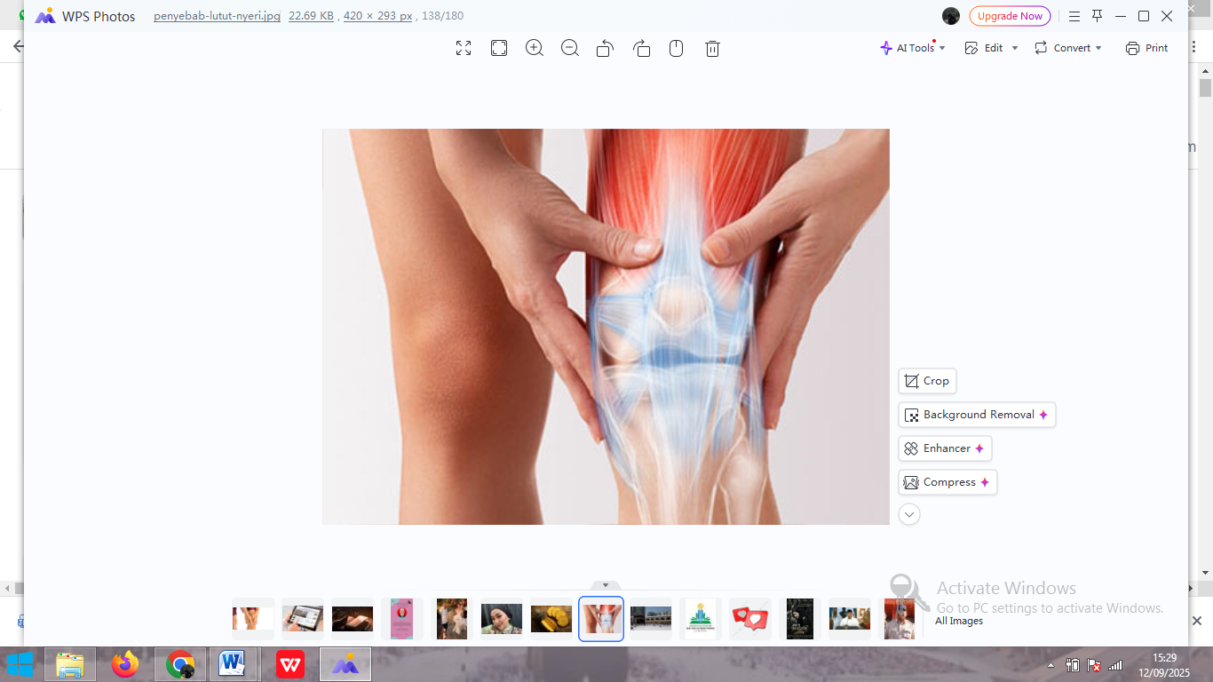 ilutrasi lutut (klinik patella)