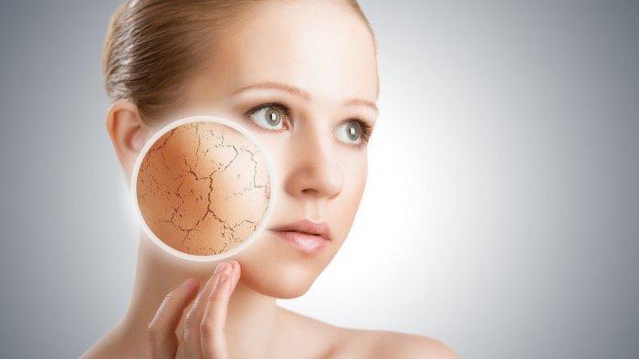 ILUSTRASI: Kulit kering (Life Force Homeopathy