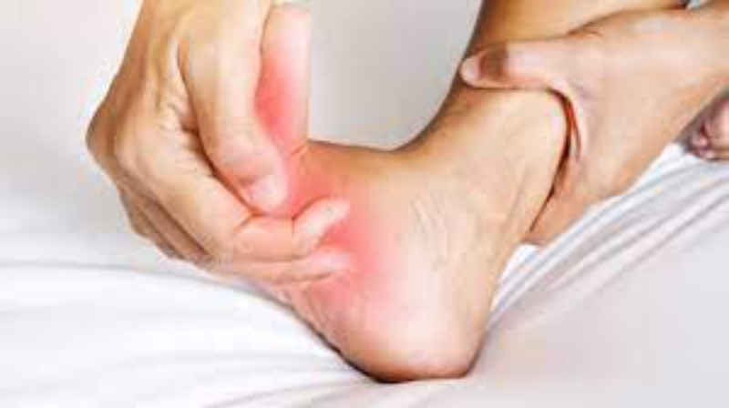 Ilustrasi kram kaki. (Istimewa)