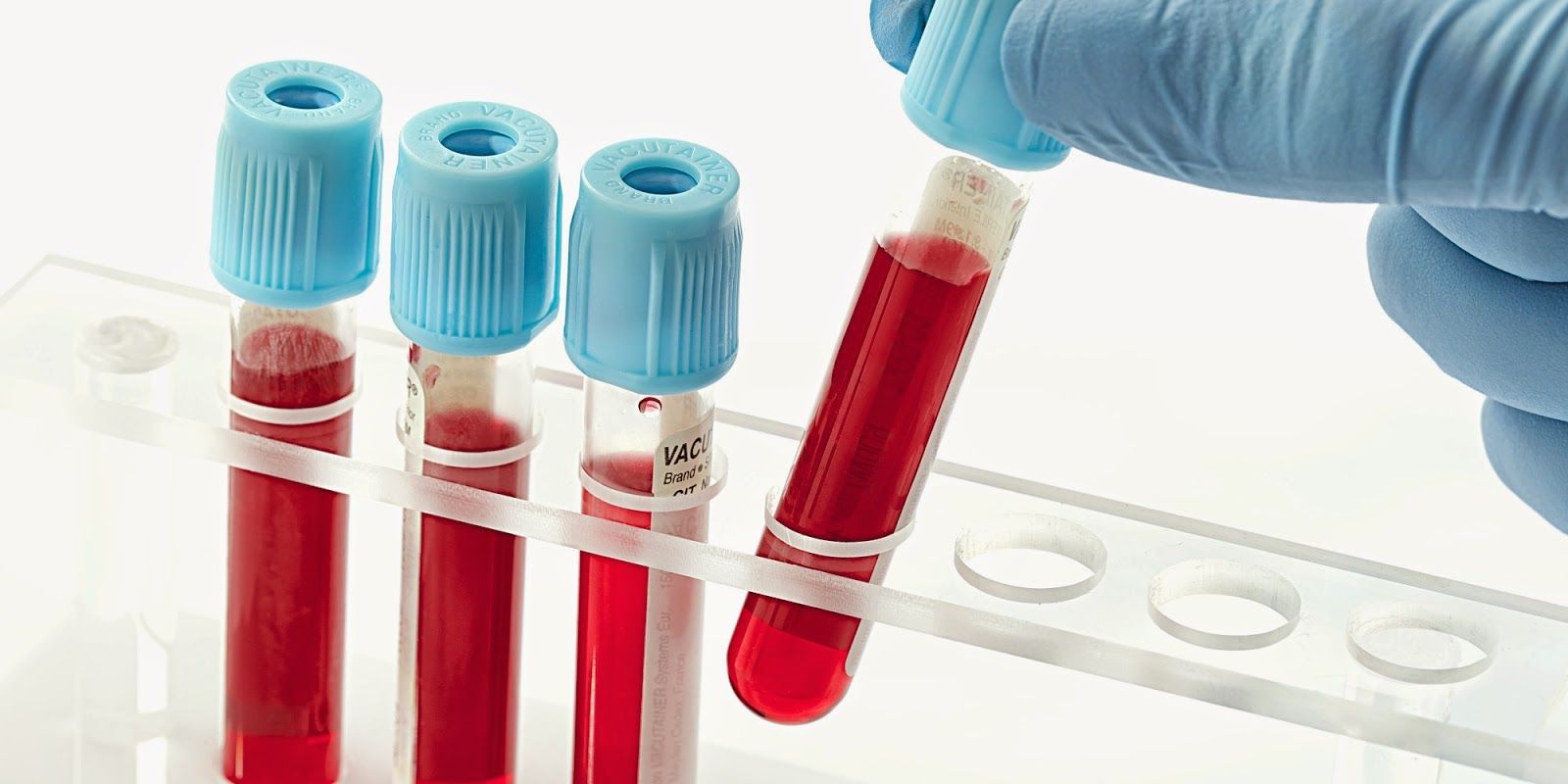 Rumah sakit di Tiongkok menemukan urutan genetik baru dari golongan darah p yang langka.