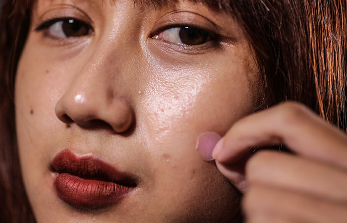BERI PERLINDUNGAN: Acne patch bisa digunakan untuk menutupi jerawat dari penggunaan make up. Bisa juga untuk menghalau debu dan menghindari tersentuhnya jerawat oleh tangan.