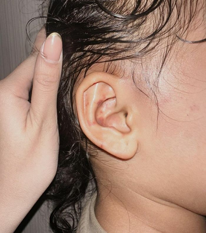 Viral, Anak Selebgram Aghnia Dianiaya Oleh Babysitter Sampai Mata Lebam.