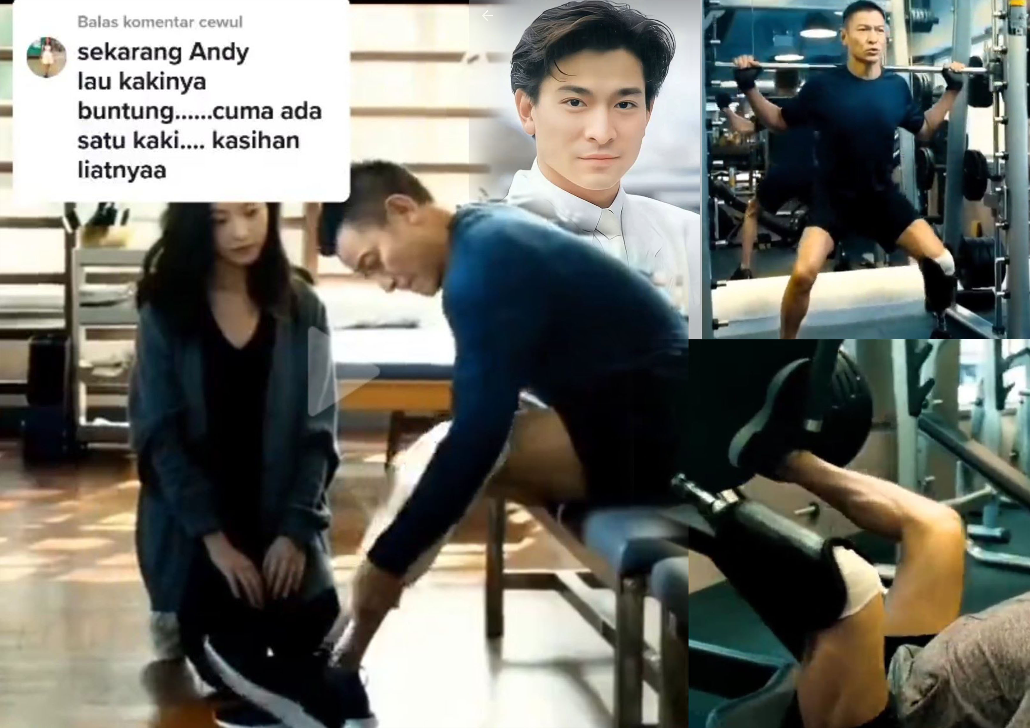 Penampilan Andy Lau dengan kaki diamputasi.