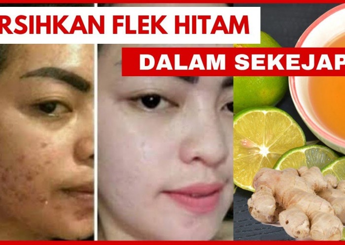Resep Minuman Kolagen untuk Bersihkan Flek Hitam.