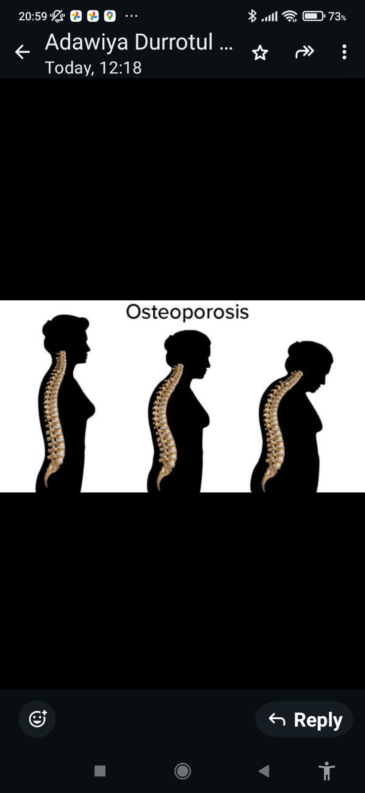 Ilustrasi Osteoporosis (kabar6.com)