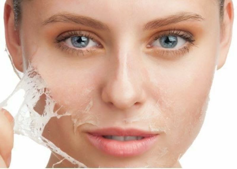 Eksfoliasi kulit wajah.