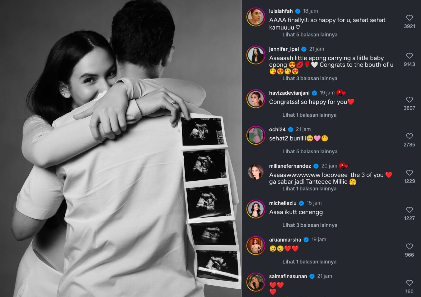 Steffi Zamora umumkan kehamilan anak pertamanya bersama Nino Fernandez dan bagikan foto hasil USG calon buah hati mereka pada Selasa (9/9/2025). (Instagram /@steffizamoraaa).