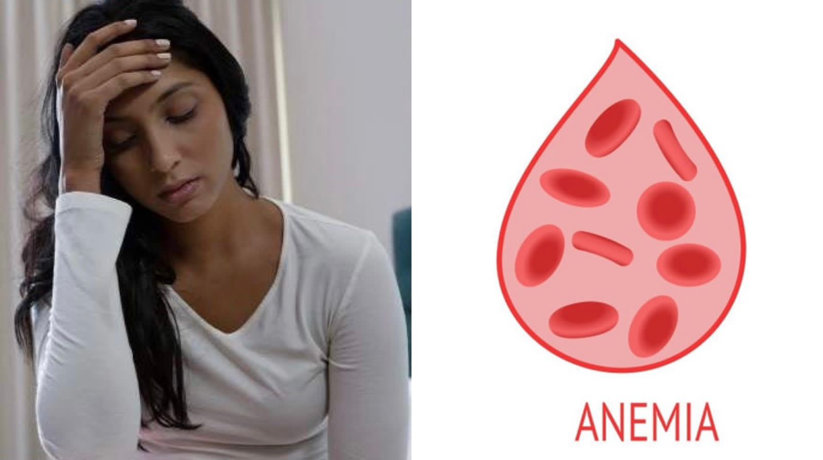 Ilustrasi orang mengalami anemia.