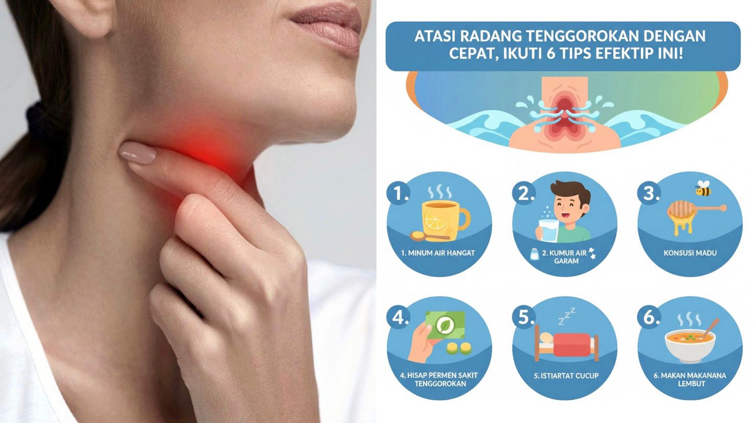 Ilustrasi Atasi Radang Tenggorokan dengan Cepat, Ikuti 6 Tips Efektif Ini!