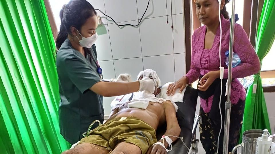 LUKA BAKAR: Korban ledakan kompor mayat menjalani perawatan medis di RSUD Negara, Kamis (28/12).