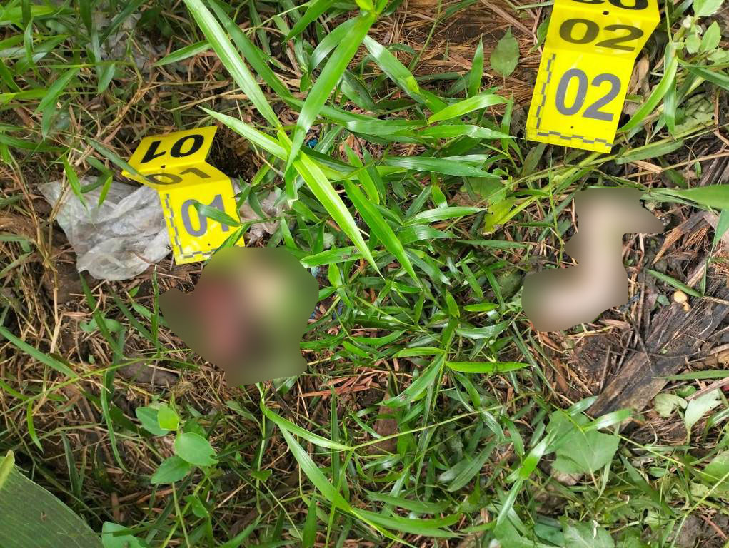 Potongan kaki bayi yang ditemukan di sekitar rumah warga, di Desa Kalianget, Kecamatan Seririt, Buleleng, Bali