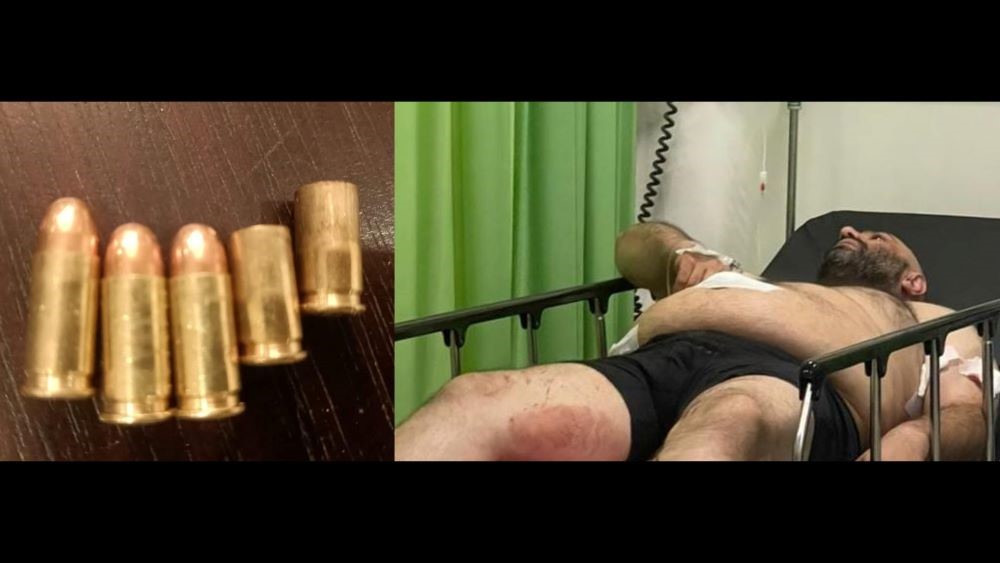 DALAM PERAWATAN: Turis Turki korban penembakan dirawat di RS Trijata dan sisa peluru serta selongsong yang diamankan.