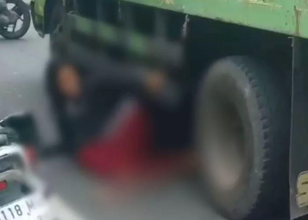 TERLUKA: Korban kecelakaan di Klungkung, Bali terlindas truk hingga menyebabkan kakinya patah.