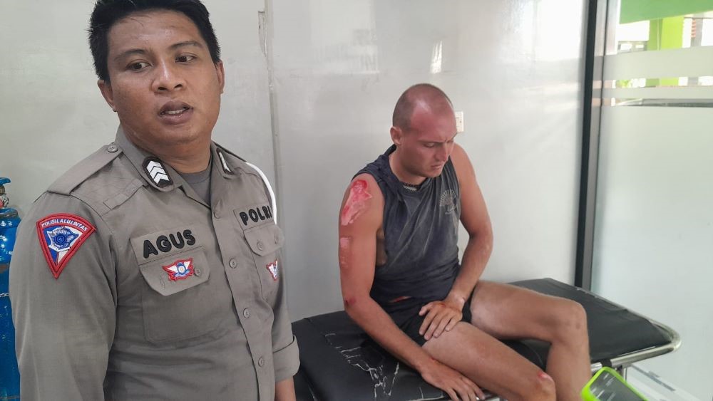 LUKA RINGAN: Korban WNA mengalami luka ringan akibat kecelakaan bertabrakan di wilayah Abang, Karangasem.