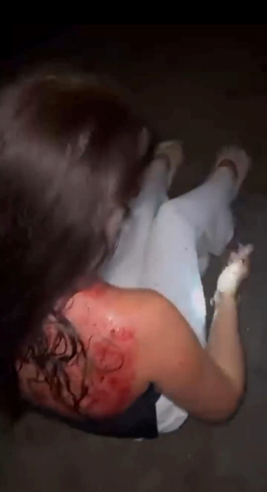 WNA asal Inggris terluka  akibat perampokan serta penganiayaan orang tak dikenal di Kuta,  Bali.