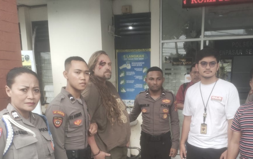 LUKA: Mata Christoper terluka karena tabrak mobil saat berusaha kabur dari aksi mencuri perhiasan.
