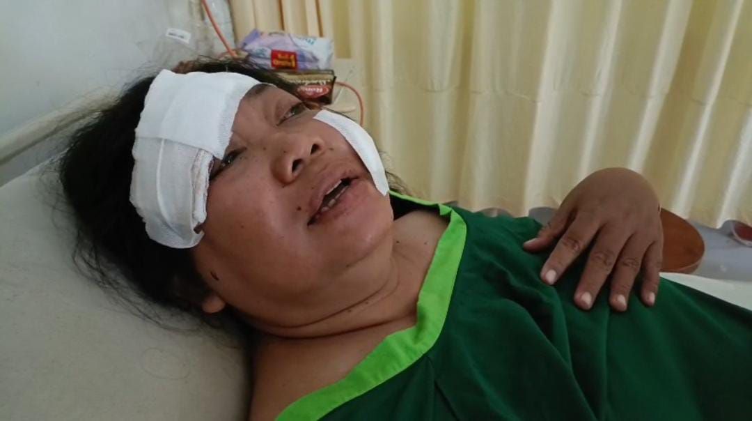 Pengemudi Ojol Yuni Handayani korban begal di Klungkung mendapat perawatan intensif di rumah sakit.