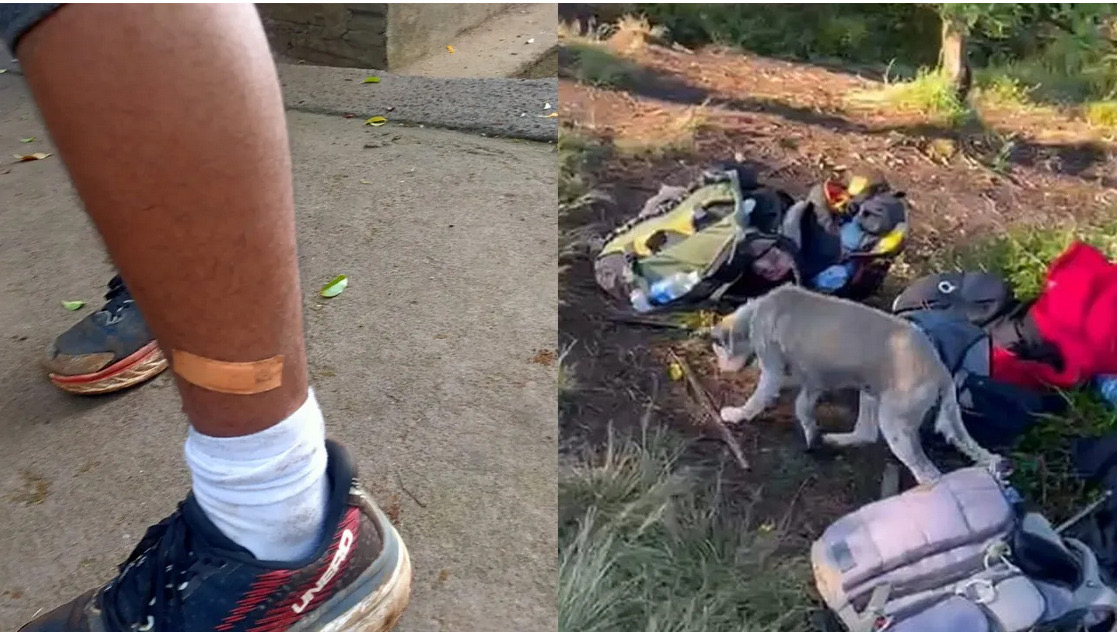 Kasus gigitan anjing liar terhadap 15 pendaki di kawasan Gunung Batukaru beberapa waktu lalu.