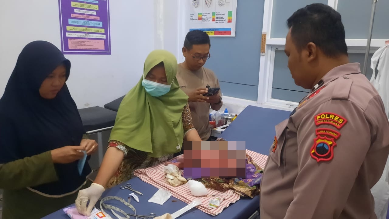 DIDUGA DIBUANG: Bayi perempuan yang ditemukan di sebuah angkringan Desa Karangdadap saat dirawat di puskemas.