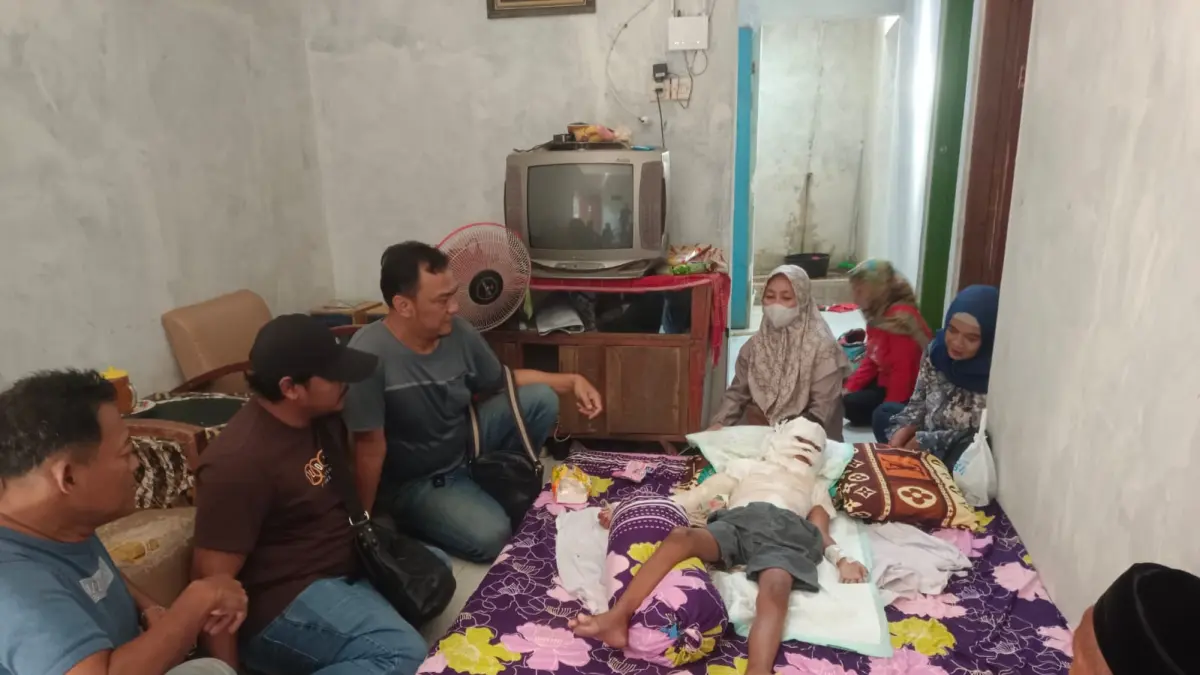 LUKA BAKAR: Anggota DPRD Batang saat menjenguk korban terbakar di Proyonanggan Selatan.