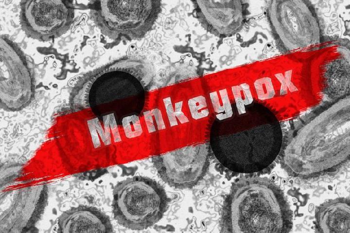 Adanya kasus cacar monyet (monkeypox) di beberapa daerah hingga kini belum merambah Kabupaten Blitar. Terbukti dari data dinas kesehatan (dinkes) belum ada temuan dan laporan warga yang terkena cacar