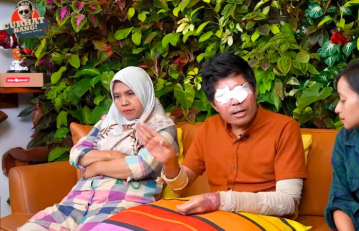 Agus Salim, Korban Penyiraman Air Keras Saat di Podcast Denny Sumargo