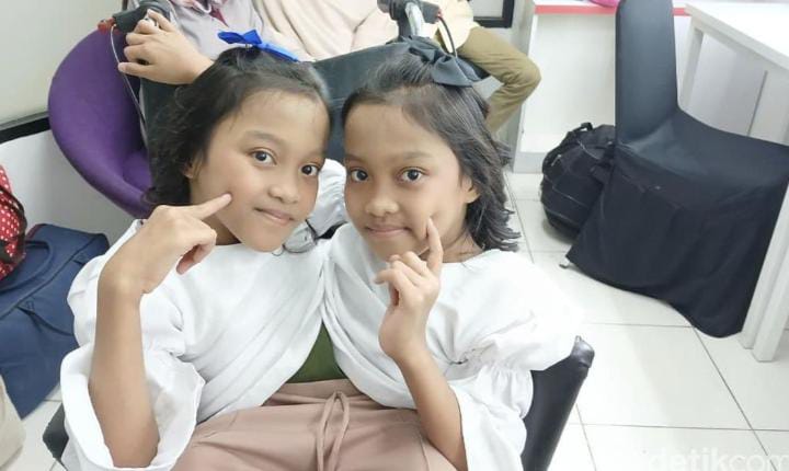 Putri dan Dewi, Kembar Siam Garut yang Punya Mental Baja: &ldquo;Kami Nggak Minder, Cuma Beda Sedikit Aja&rdquo;