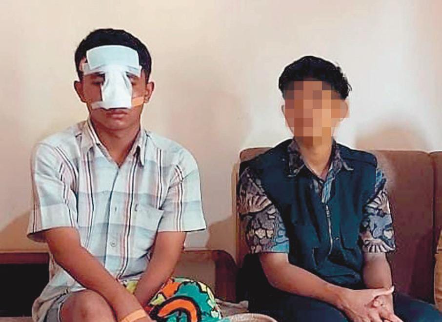 Dipukul Kakak Kelas Sampai Patah Tulang Hidung, Pelajar SMKN 1 Kademangan Blitar Trauma Sekolah Lagi