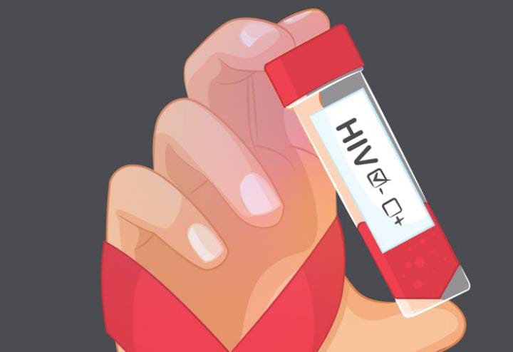 Ratusan Kasus Baru HIV/AIDS Terungkap di Kabupaten Blitar, Dinkes Beberkan Faktanya