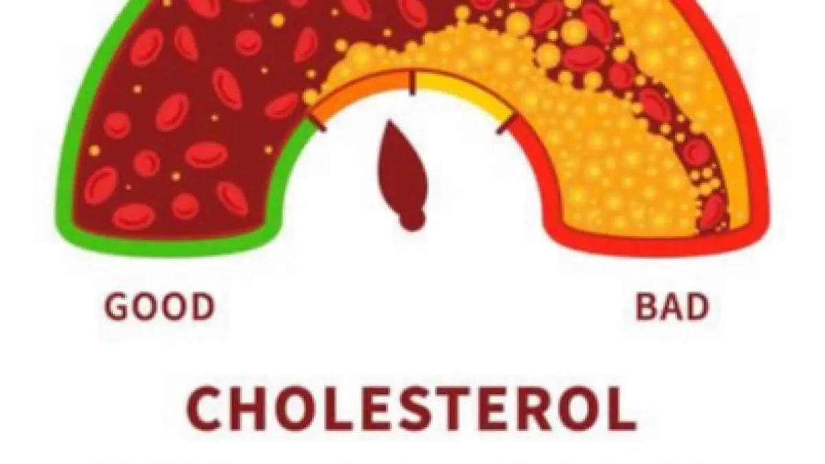 Kolesterol tinggi tidak selalu berarti buruk. Kenali perbedaan HDL dan LDL, bahaya penumpukan kolesterol, serta cara menjaga kadar kolesterol tetap normal.(pinterest)