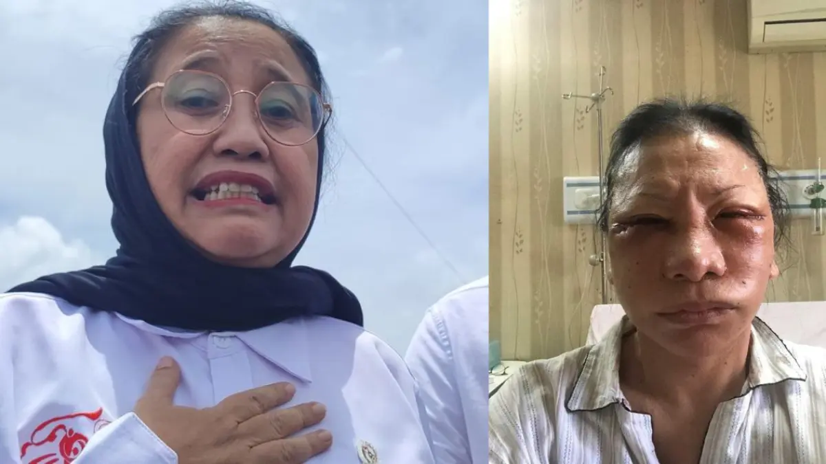Nanik S. Deyang, Kepala BGN Baru dan Kasus Ratna Sarumpaet (X/dimarsasongko98)