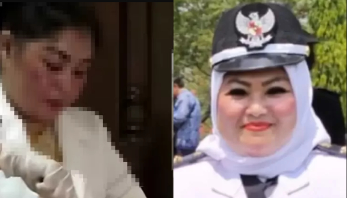 Bidan sekaligus lurah Zainab diduga lakukan malapraktik pada pasien.