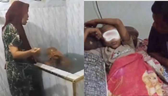 Bocah SMP di Aceh jadi korban disiram air cabai oleh istri pimpinan pesantren.