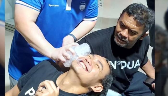 Foto Benediktus Adi korban pemukulan oknum suporter Persis Solo