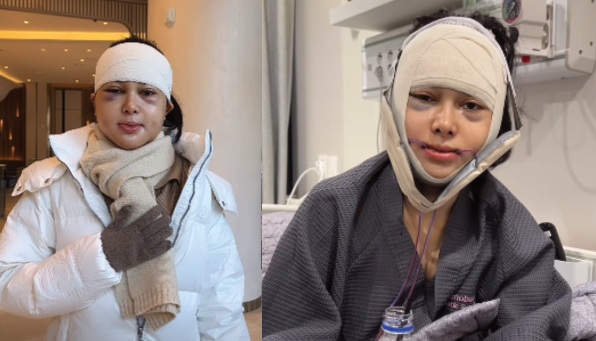 Kondisi Dilan Janiar Usai jalani operasi di Korea.